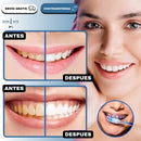 Crema Blanqueadora Hismile